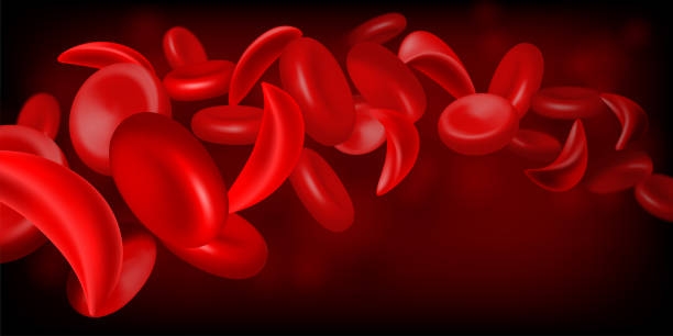 EXPLAINER: What you need to know about Sickle Cell