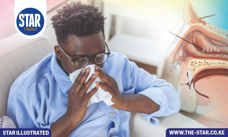 What to know about allergic rhinitis
