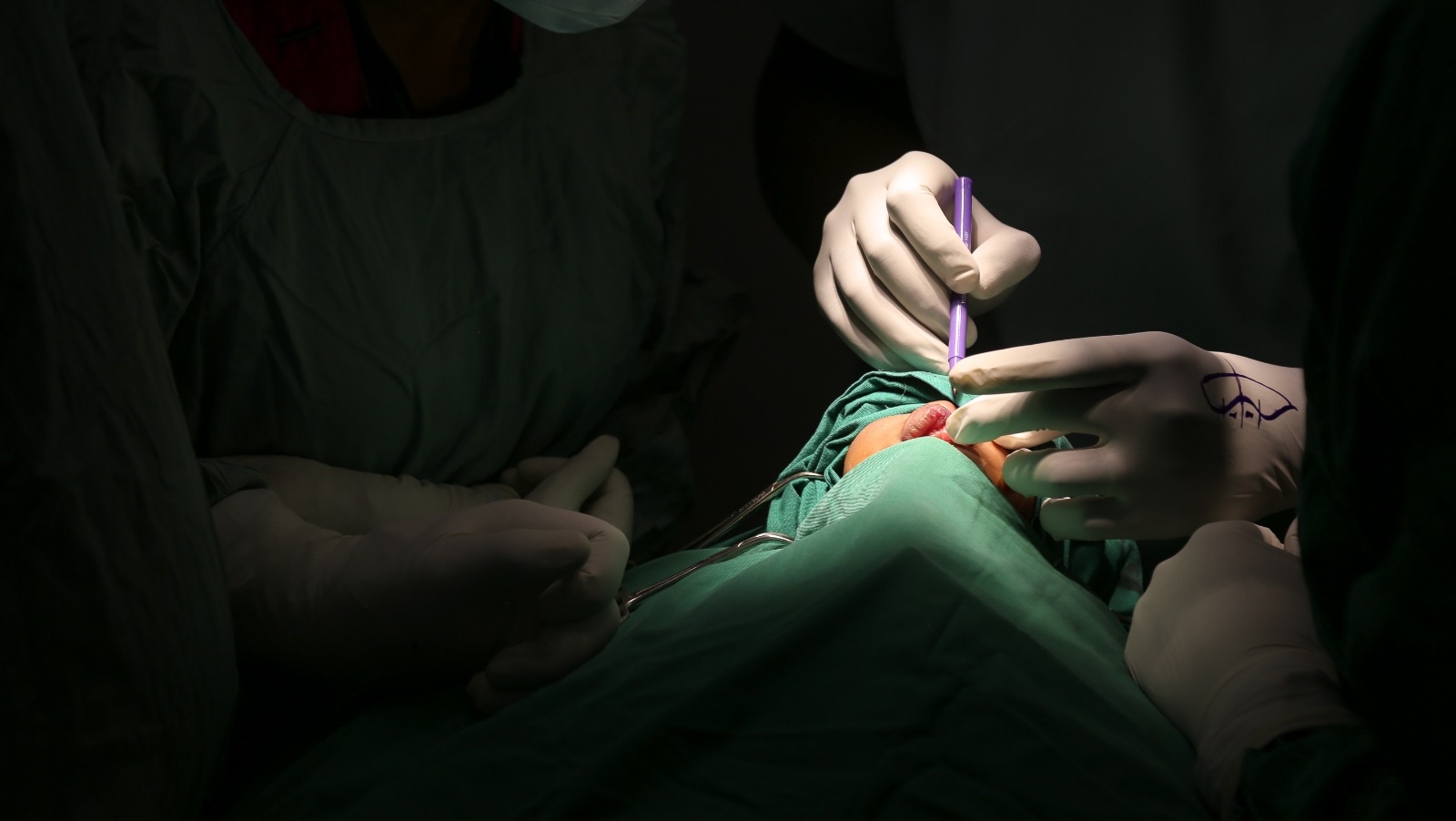 Free surgeries bring new hope to Cleft patients at JOOTRH