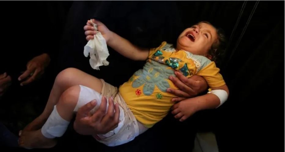 Government plans to bring more Gazan children to UK for treatment