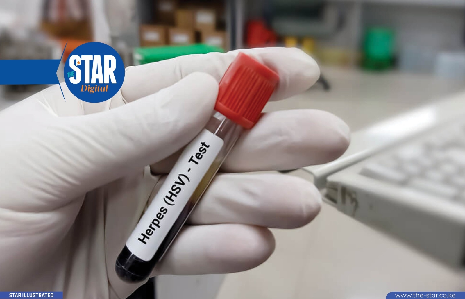 Men vs Women: Who is more prone to Sexually Transmitted Infections?