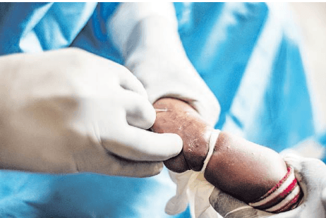 Kenya to access more tools for mpox testing