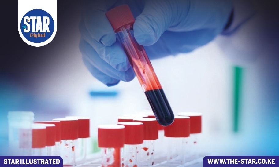 Prevalence of STIs at county level: Where most cases were reported